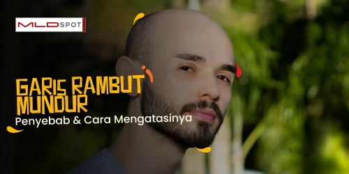 Kenapa Garis Rambut Mundur dan Cara Mengatasinya